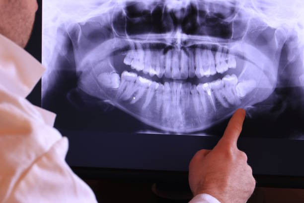 Best Emergency Gum Treatment in Euharlee, GA